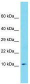 Mitotic Spindle Organizing Protein 1 antibody, TA337453, Origene, Western Blot image 