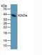 Interleukin 11 Receptor Subunit Alpha antibody, LS-C294824, Lifespan Biosciences, Western Blot image 