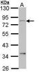 Carcinoembryonic Antigen Related Cell Adhesion Molecule 1 antibody, GTX113392, GeneTex, Western Blot image 