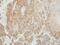 Ubiquitin C-Terminal Hydrolase L1 antibody, GTX101093, GeneTex, Immunohistochemistry paraffin image 
