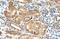 GDP-Mannose Pyrophosphorylase B antibody, NBP1-55168, Novus Biologicals, Immunohistochemistry frozen image 