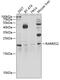 Retinoic Acid Receptor Responder 2 antibody, 22-590, ProSci, Western Blot image 