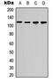 RB Transcriptional Corepressor Like 1 antibody, GTX55251, GeneTex, Western Blot image 