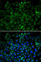 Cyclin Dependent Kinase 1 antibody, LS-C746813, Lifespan Biosciences, Immunofluorescence image 