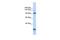 Membrane Integral NOTCH2 Associated Receptor 1 antibody, GTX46362, GeneTex, Western Blot image 