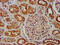 Sorting Nexin 12 antibody, CSB-PA891787LA01HU, Cusabio, Immunohistochemistry paraffin image 