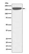 SOS Ras/Rac Guanine Nucleotide Exchange Factor 1 antibody, M00837, Boster Biological Technology, Western Blot image 