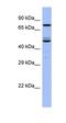 TBC1 Domain Family Member 25 antibody, orb326096, Biorbyt, Western Blot image 