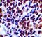 SWI/SNF Related, Matrix Associated, Actin Dependent Regulator Of Chromatin, Subfamily B, Member 1 antibody, LS-C312077, Lifespan Biosciences, Immunohistochemistry paraffin image 