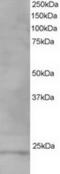 VPS28 Subunit Of ESCRT-I antibody, TA302924, Origene, Western Blot image 