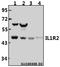 Interleukin 1 Receptor Type 2 antibody, A03106-2, Boster Biological Technology, Western Blot image 