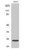 Potassium Calcium-Activated Channel Subfamily M Regulatory Beta Subunit 4 antibody, A06117, Boster Biological Technology, Western Blot image 