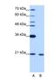 RNA Binding Motif Protein 8A antibody, NBP1-57274, Novus Biologicals, Western Blot image 