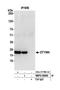 Thymidylate kinase antibody, NBP2-59095, Novus Biologicals, Western Blot image 