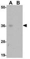 ABIN3 antibody, GTX85255, GeneTex, Western Blot image 