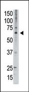 MAGE Family Member D2 antibody, 62-158, ProSci, Western Blot image 