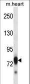 SCY1 Like Pseudokinase 3 antibody, LS-C164572, Lifespan Biosciences, Western Blot image 