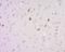 EPH Receptor A8 antibody, orb101151, Biorbyt, Immunohistochemistry paraffin image 