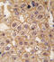 Adrenoceptor Beta 2 antibody, abx033278, Abbexa, Immunohistochemistry paraffin image 