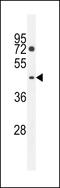 Acy1l2 antibody, 55-865, ProSci, Western Blot image 