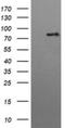 Hepatocyte Growth Factor-Regulated Tyrosine Kinase Substrate antibody, NBP2-45734, Novus Biologicals, Western Blot image 
