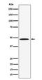 Prolyl 4-Hydroxylase, Transmembrane antibody, M12260, Boster Biological Technology, Western Blot image 