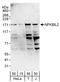 Tonsoku Like, DNA Repair Protein antibody, A303-843A, Bethyl Labs, Western Blot image 