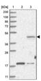 Threonine Synthase Like 2 antibody, PA5-57258, Invitrogen Antibodies, Western Blot image 