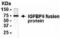 Insulin Like Growth Factor Binding Protein 6 antibody, XW-7995, ProSci, Western Blot image 