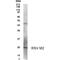 Respiratory Syncytial Virus M2 Protein antibody, PA1-23415, Invitrogen Antibodies, Western Blot image 