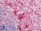 C-C Motif Chemokine Receptor 5 (Gene/Pseudogene) antibody, LS-B12517, Lifespan Biosciences, Immunohistochemistry paraffin image 