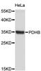 Pyruvate Dehydrogenase E1 Beta Subunit antibody, STJ24940, St John