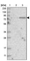 Kyphoscoliosis Peptidase antibody, NBP1-93859, Novus Biologicals, Western Blot image 