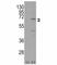 Nuclear Receptor Subfamily 4 Group A Member 1 antibody, F49565-0.4ML, NSJ Bioreagents, Western Blot image 