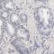 Laminin Subunit Beta 1 antibody, HPA004132, Atlas Antibodies, Immunohistochemistry paraffin image 