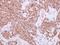 Cyclin A2 antibody, GTX103043, GeneTex, Immunohistochemistry paraffin image 