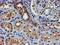 Proteasome 26S Subunit, Non-ATPase 2 antibody, M06642, Boster Biological Technology, Immunohistochemistry paraffin image 