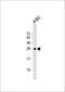 Ras-related protein Rab-27A antibody, M01608-1, Boster Biological Technology, Western Blot image 