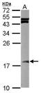 Small Ubiquitin Like Modifier 2 antibody, PA5-27636, Invitrogen Antibodies, Western Blot image 