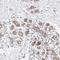 Outer Dense Fiber Of Sperm Tails 2 Like antibody, HPA028020, Atlas Antibodies, Immunohistochemistry frozen image 