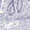 SLIT And NTRK Like Family Member 4 antibody, NBP2-55121, Novus Biologicals, Immunohistochemistry paraffin image 