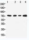 Mitogen-Activated Protein Kinase Kinase Kinase 3 antibody, LS-C313060, Lifespan Biosciences, Western Blot image 