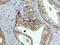 HIF1-alpha antibody, ab51608, Abcam, Immunohistochemistry paraffin image 