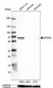 Gasdermin E antibody, NBP1-87689, Novus Biologicals, Western Blot image 