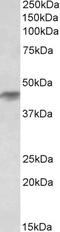 Histamine Receptor H2 antibody, EB11020, Everest Biotech, Western Blot image 