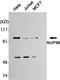 Nucleoporin 98 antibody, M01301-1, Boster Biological Technology, Western Blot image 