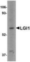 Leucine Rich Glioma Inactivated 1 antibody, TA306536, Origene, Western Blot image 