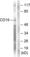 CD19 antibody, abx012770, Abbexa, Western Blot image 