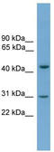 Apolipoprotein L5 antibody, TA344181, Origene, Western Blot image 