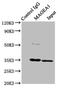 MAGE Family Member A1 antibody, LS-C376066, Lifespan Biosciences, Immunoprecipitation image 